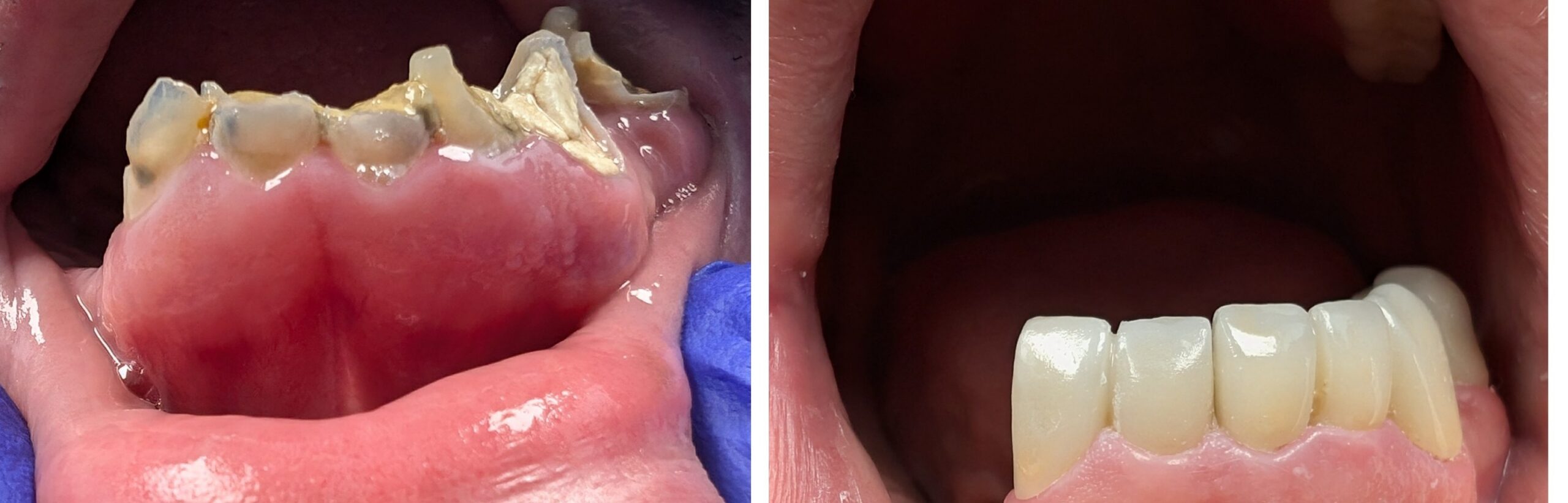Doctor Dental before and after smile transformation case 1