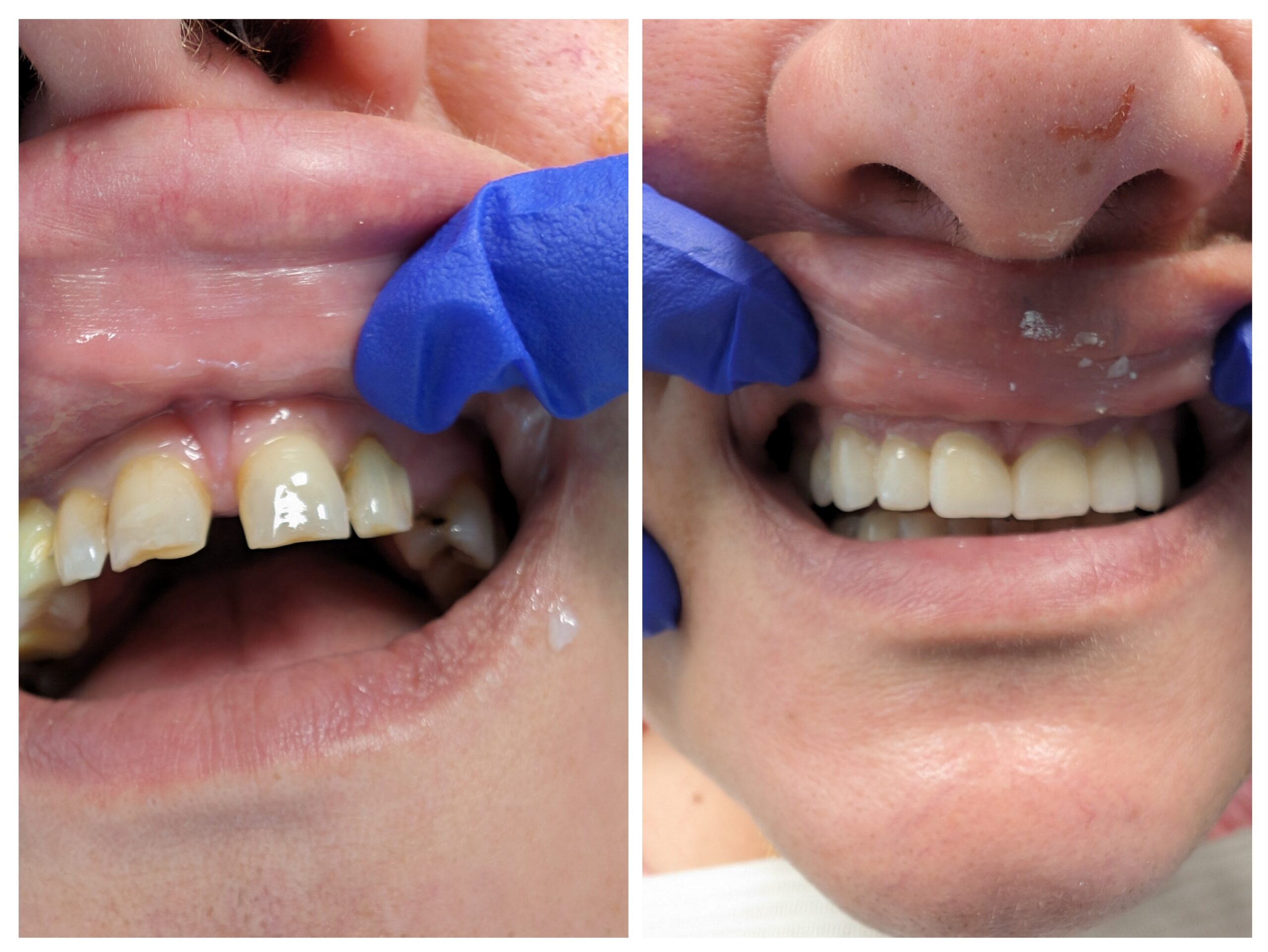 Doctor Dental before and after smile transformation case 2