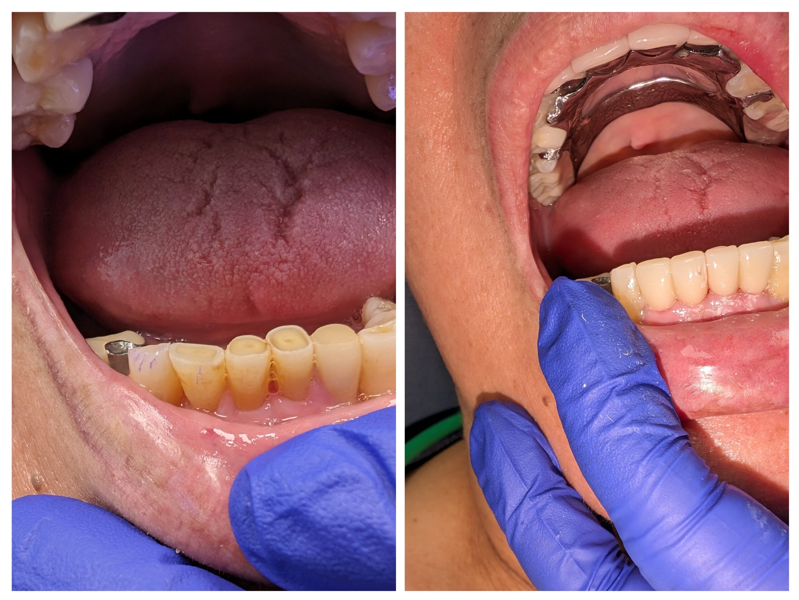 Doctor Dental before and after smile transformation case 3