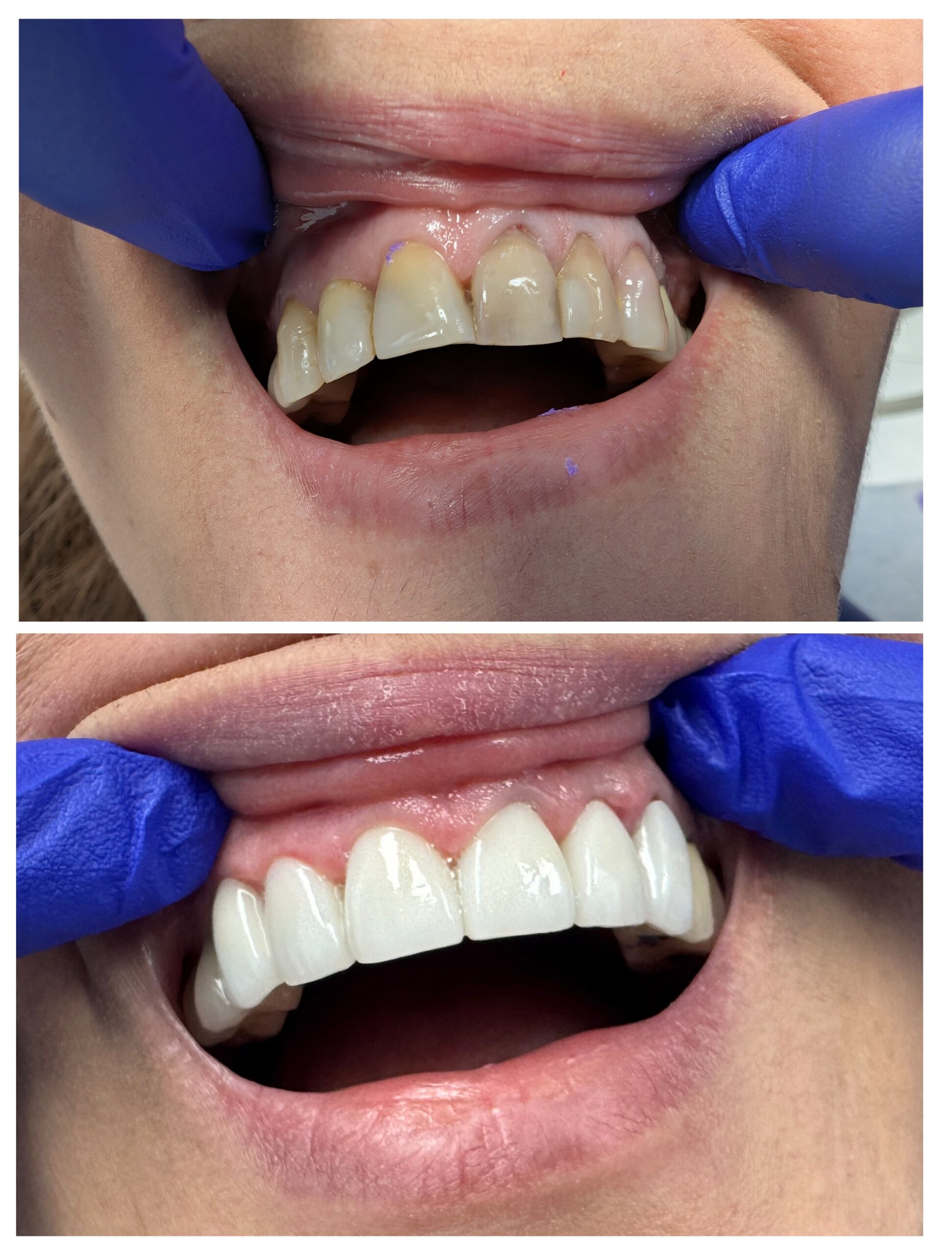 Doctor Dental before and after smile transformation case 4