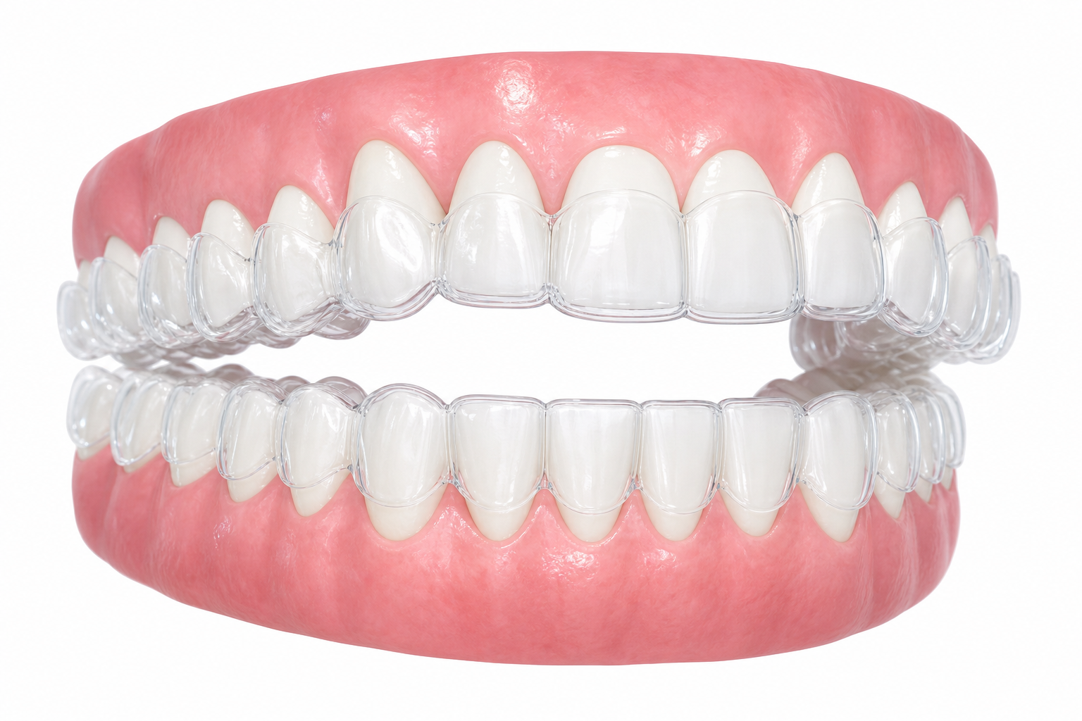 Invisalign procedure illustration at Doctor Dental in Tujunga